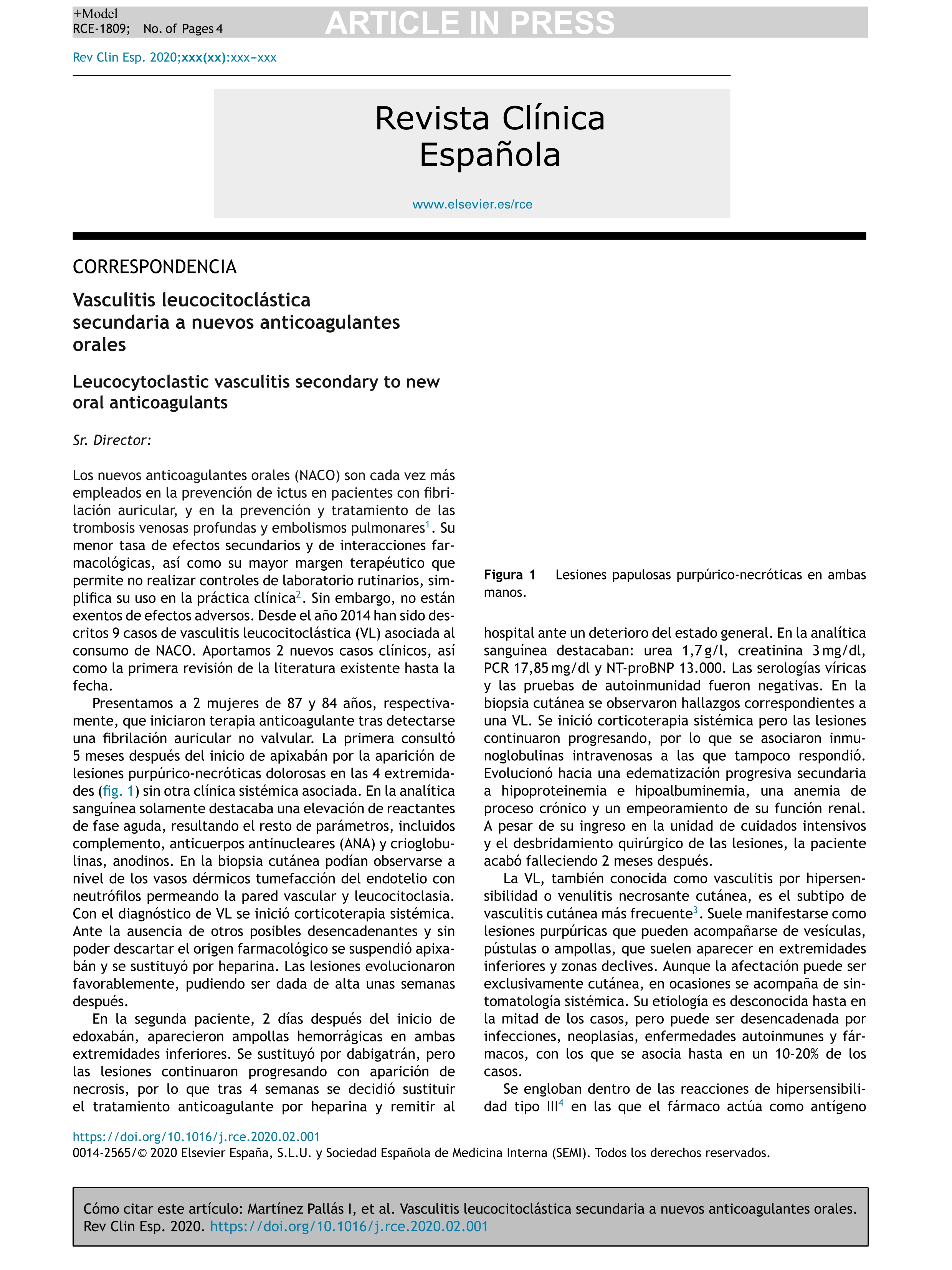 Vasculitis leucocitoclástica secundaria a nuevos anticoagulantes orales