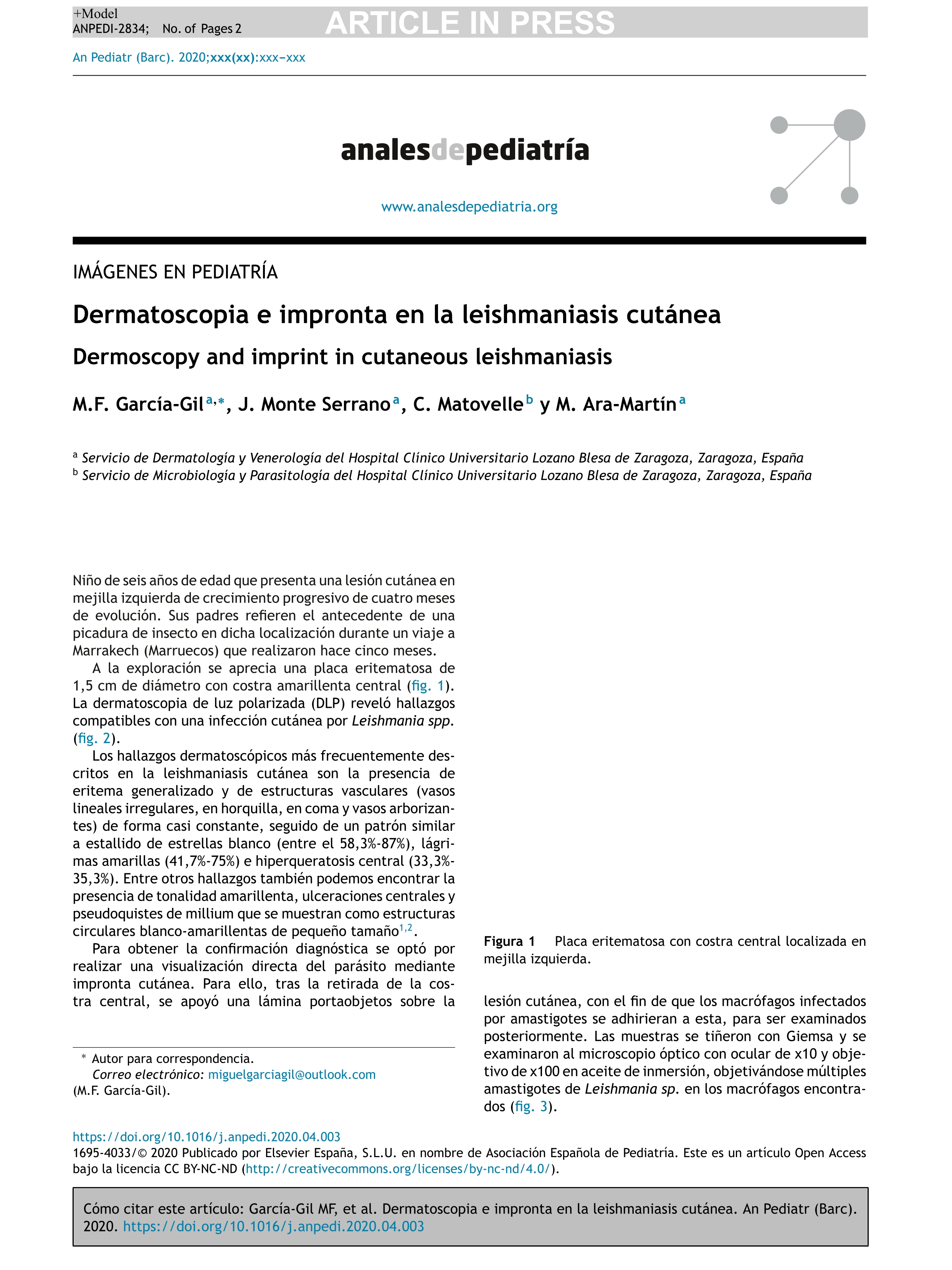 Dermatoscopia e impronta en la leishmaniasis cutánea