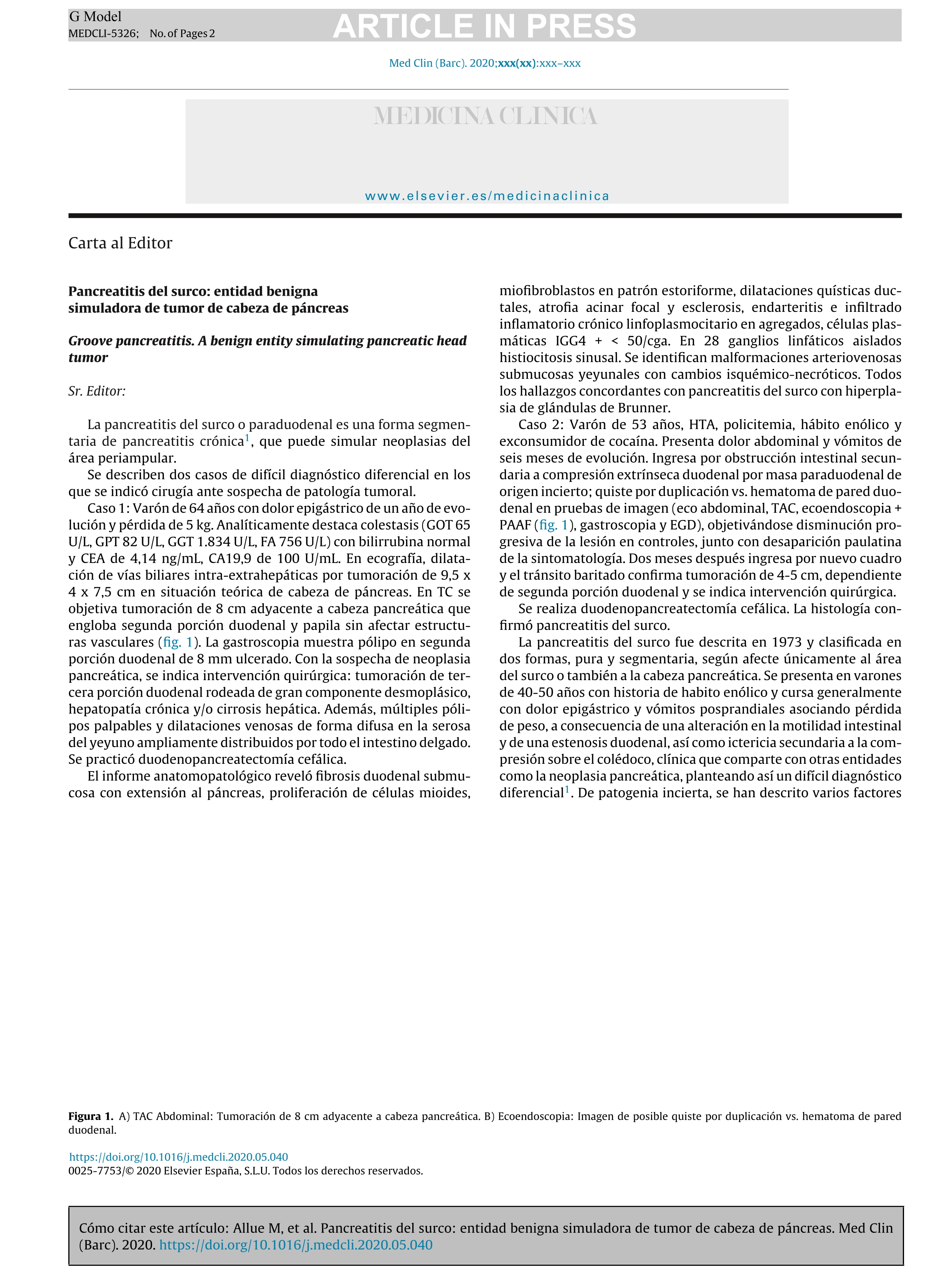 Pancreatitis del surco: entidad benigna simuladora de tumor de cabeza de páncreas