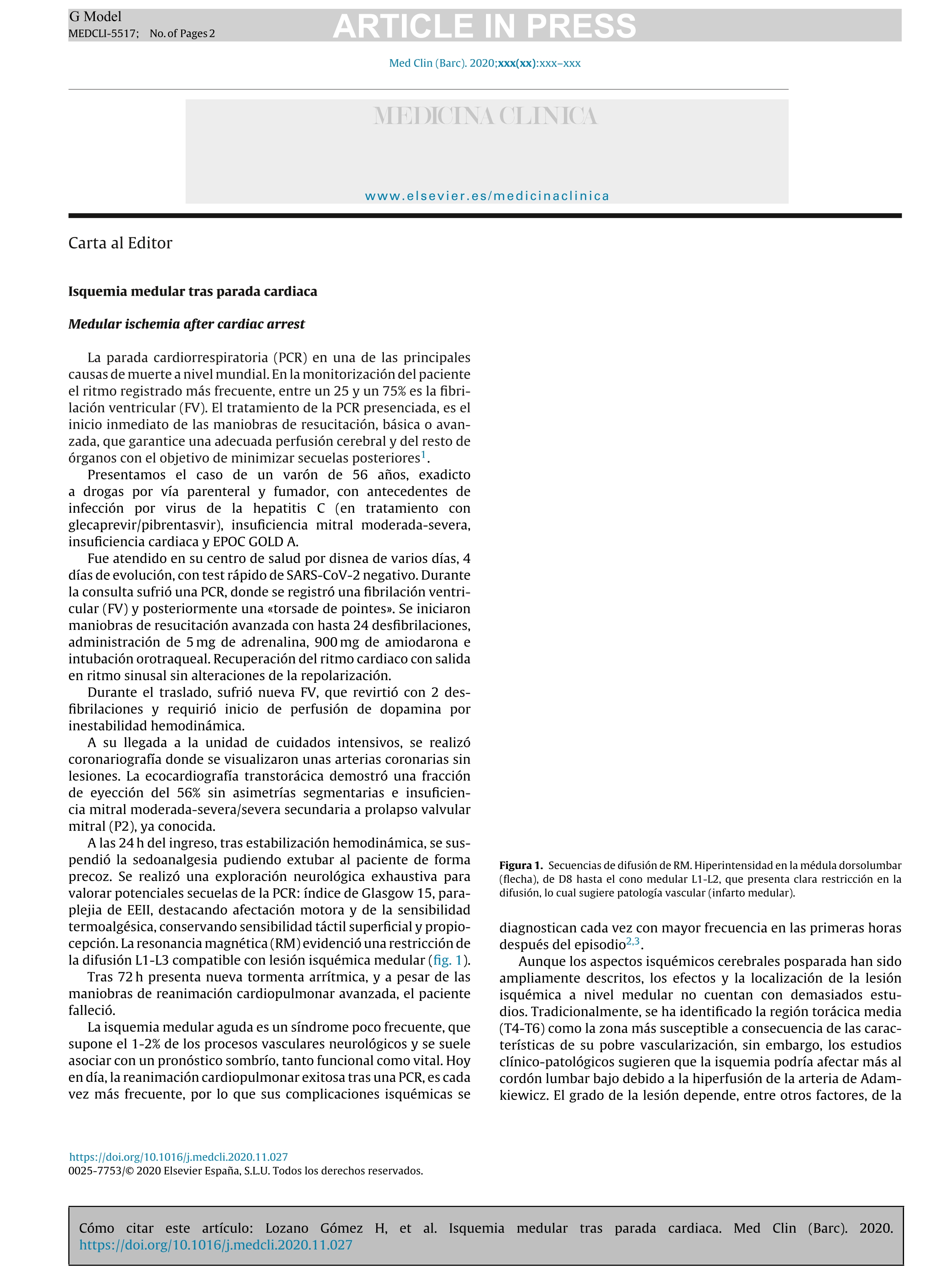 Isquemia medular tras parada cardiaca