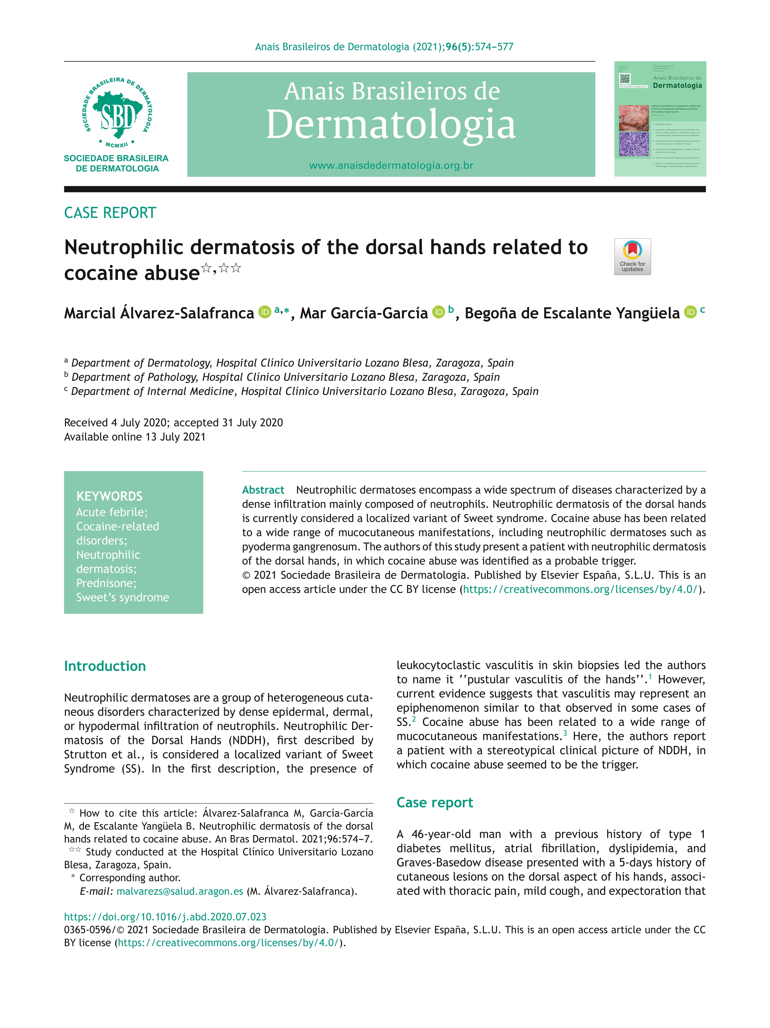 Neutrophilic dermatosis of the dorsal hands related to cocaine abuse