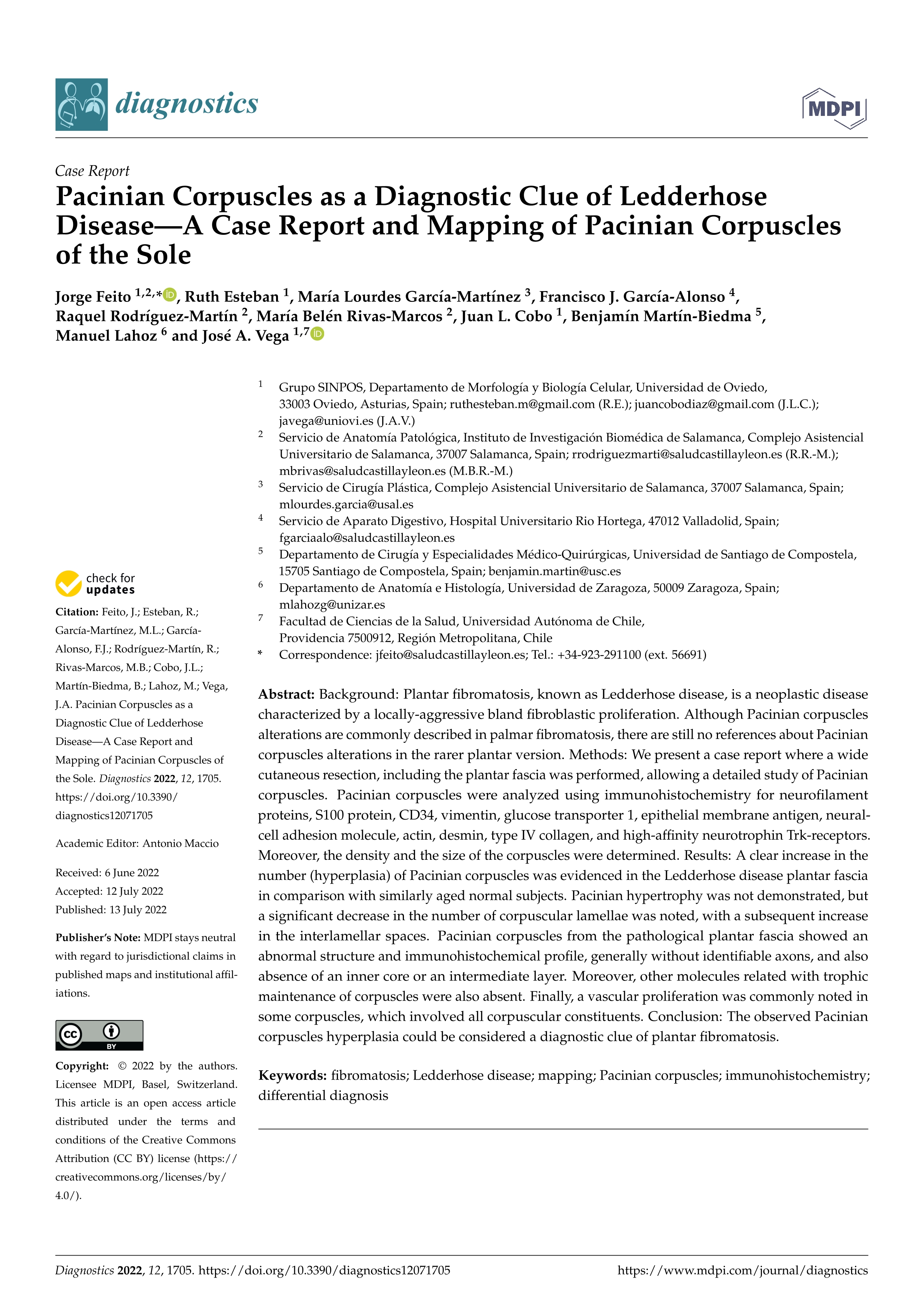 Pacinian corpuscles as a diagnostic clue of ledderhose disease-A case report and mapping of Pacinian corpuscles of the sole