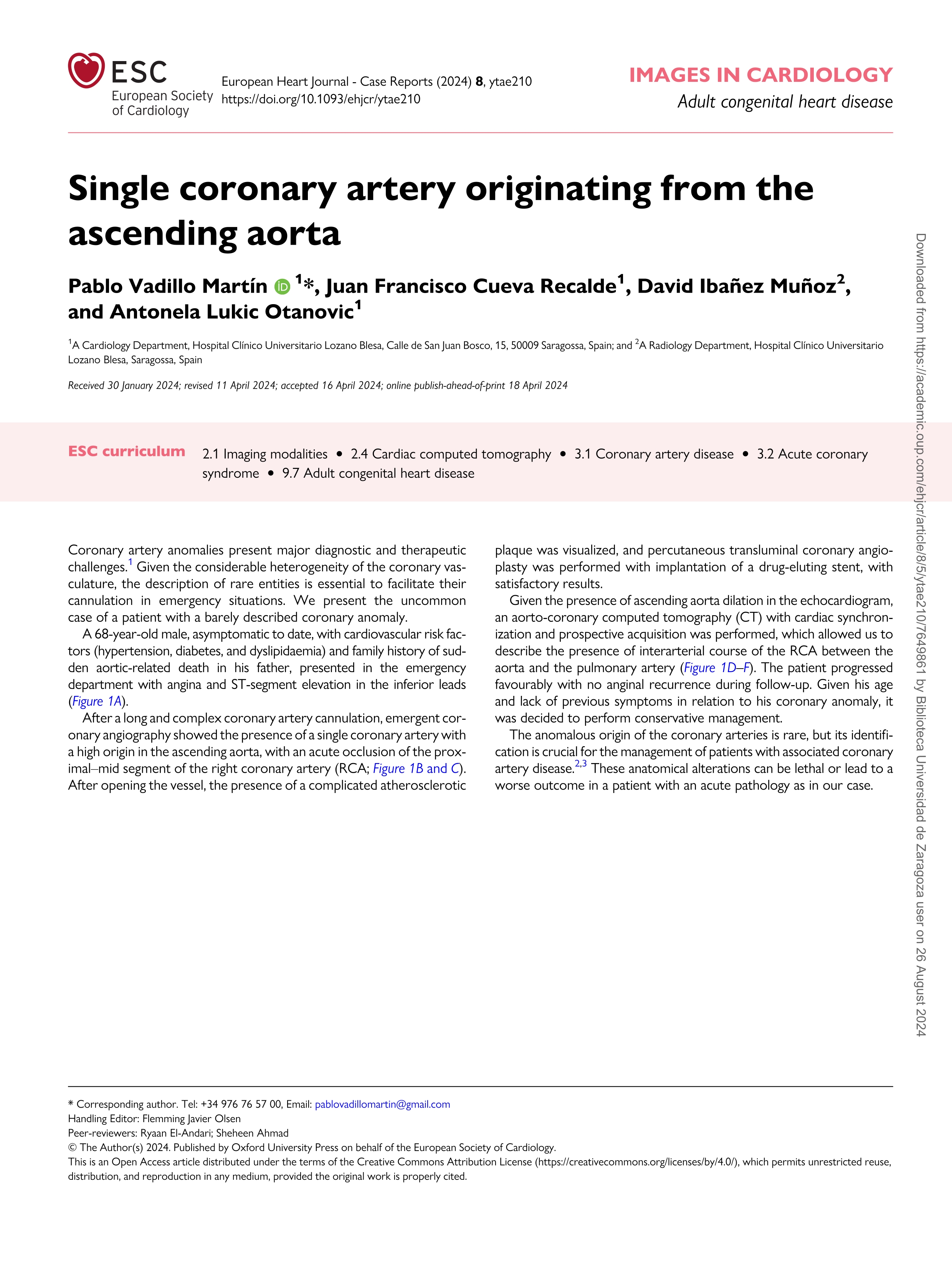 Single coronary artery originating from the ascending aorta