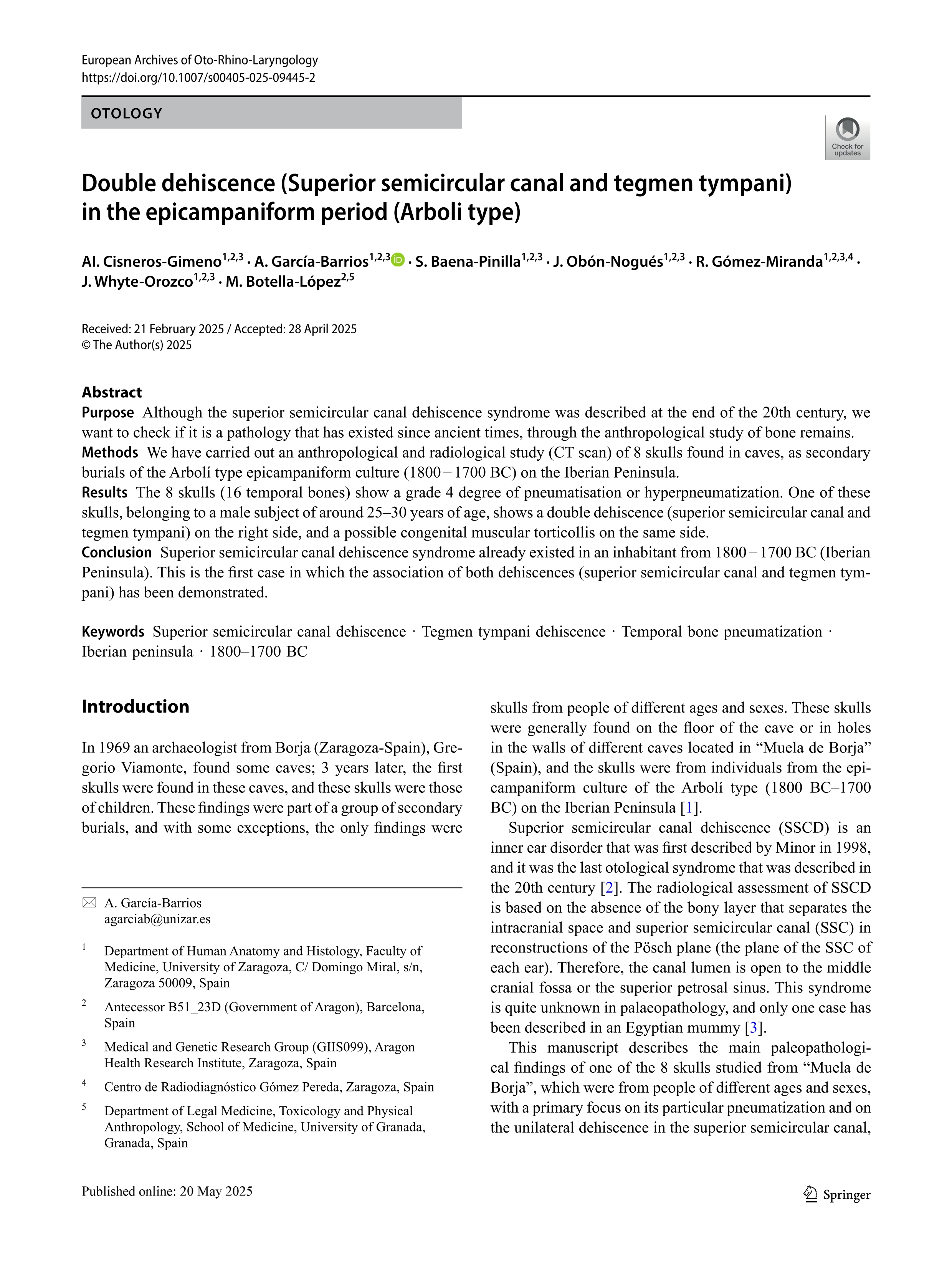 Double dehiscence (Superior semicircular canal and tegmen tympani) in the epicampaniform period (Arboli type)