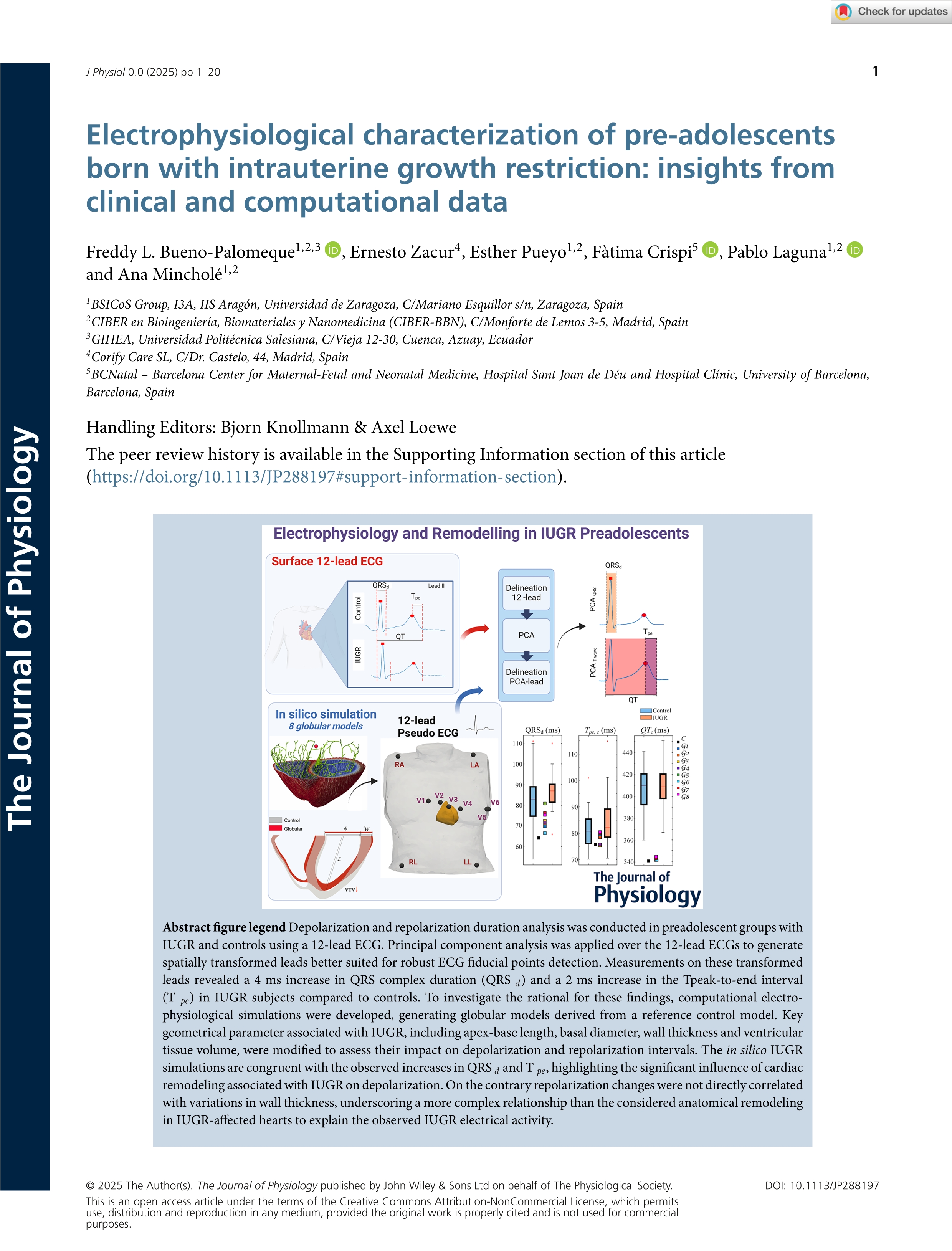 Electrophysiological characterization of pre‐adolescents born with intrauterine growth restriction: insights from clinical and computational data