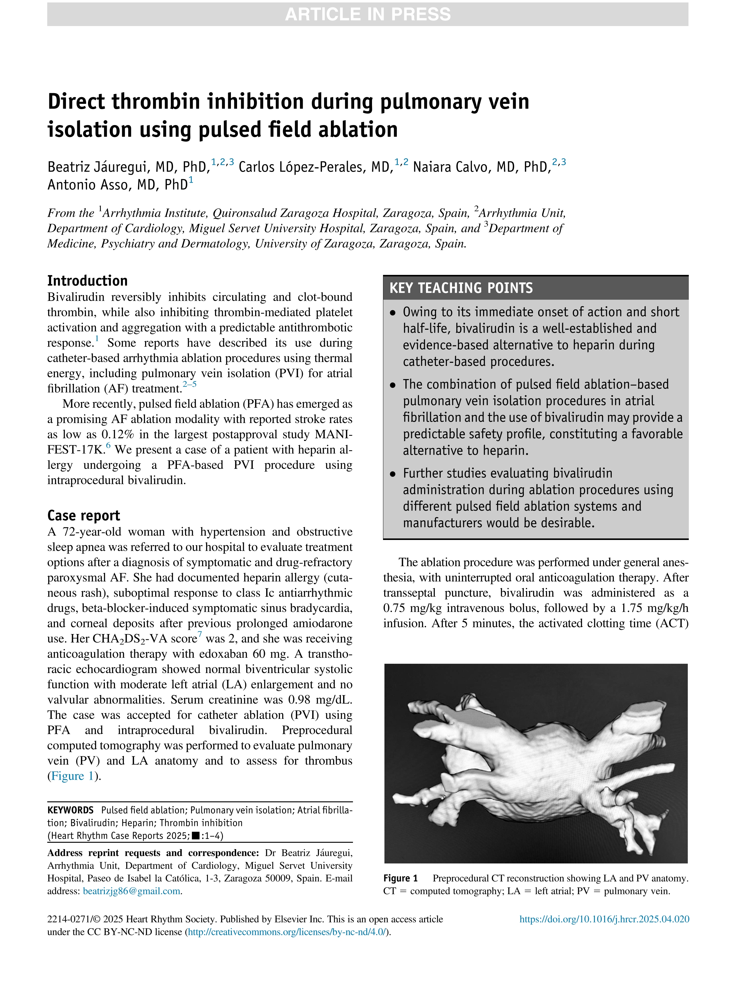 Direct thrombin inhibition during pulmonary vein isolation using pulsed field ablation