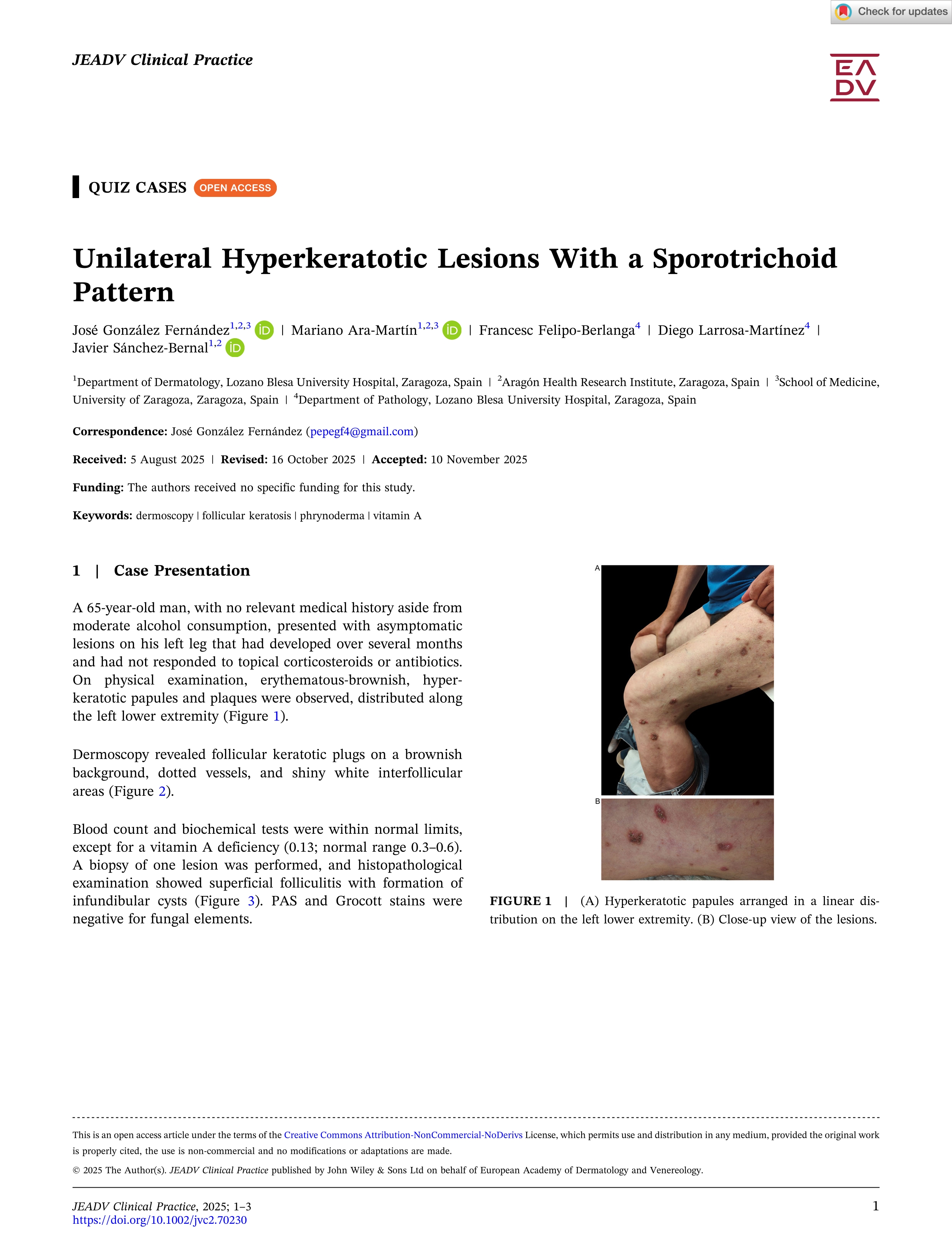 Unilateral Hyperkeratotic Lesions With a Sporotrichoid Pattern