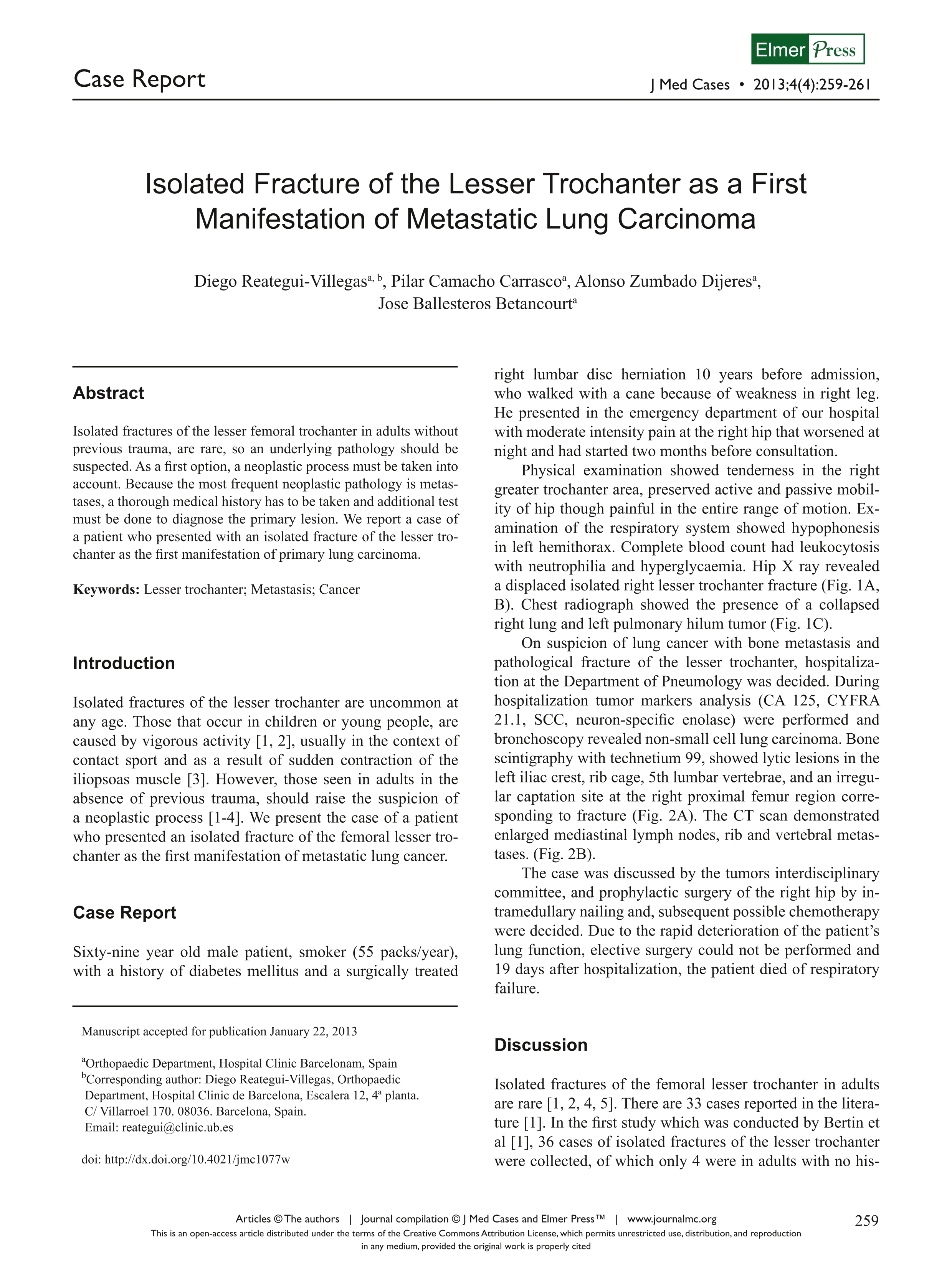 Isolated fracture of the lesser trochanter as a first manifestation of metastatic lung carcinoma.