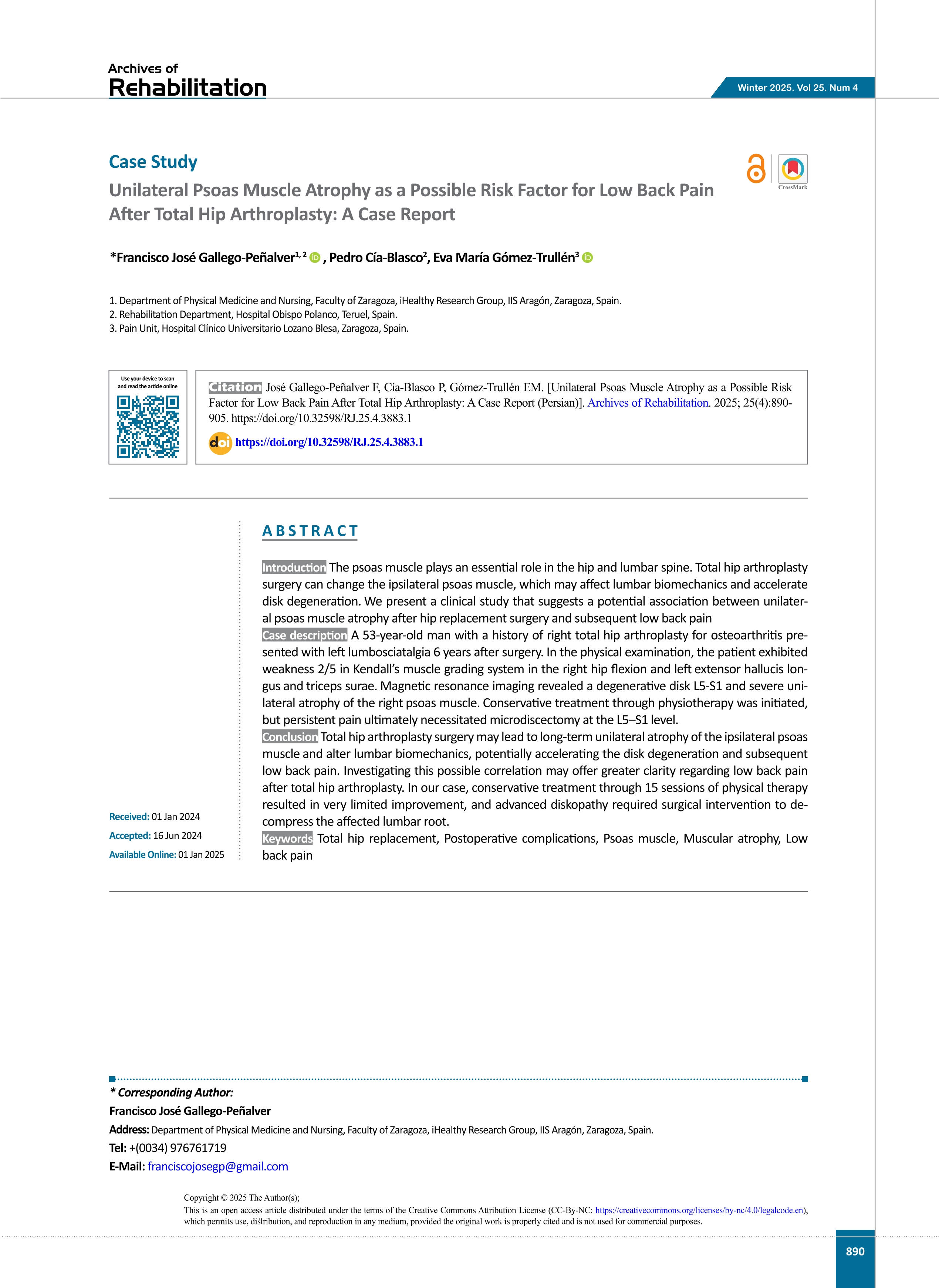 Unilateral Psoas Muscle Atrophy as a Possible Risk Factor for Low Back Pain After Total Hip Arthroplasty: A Case Report
