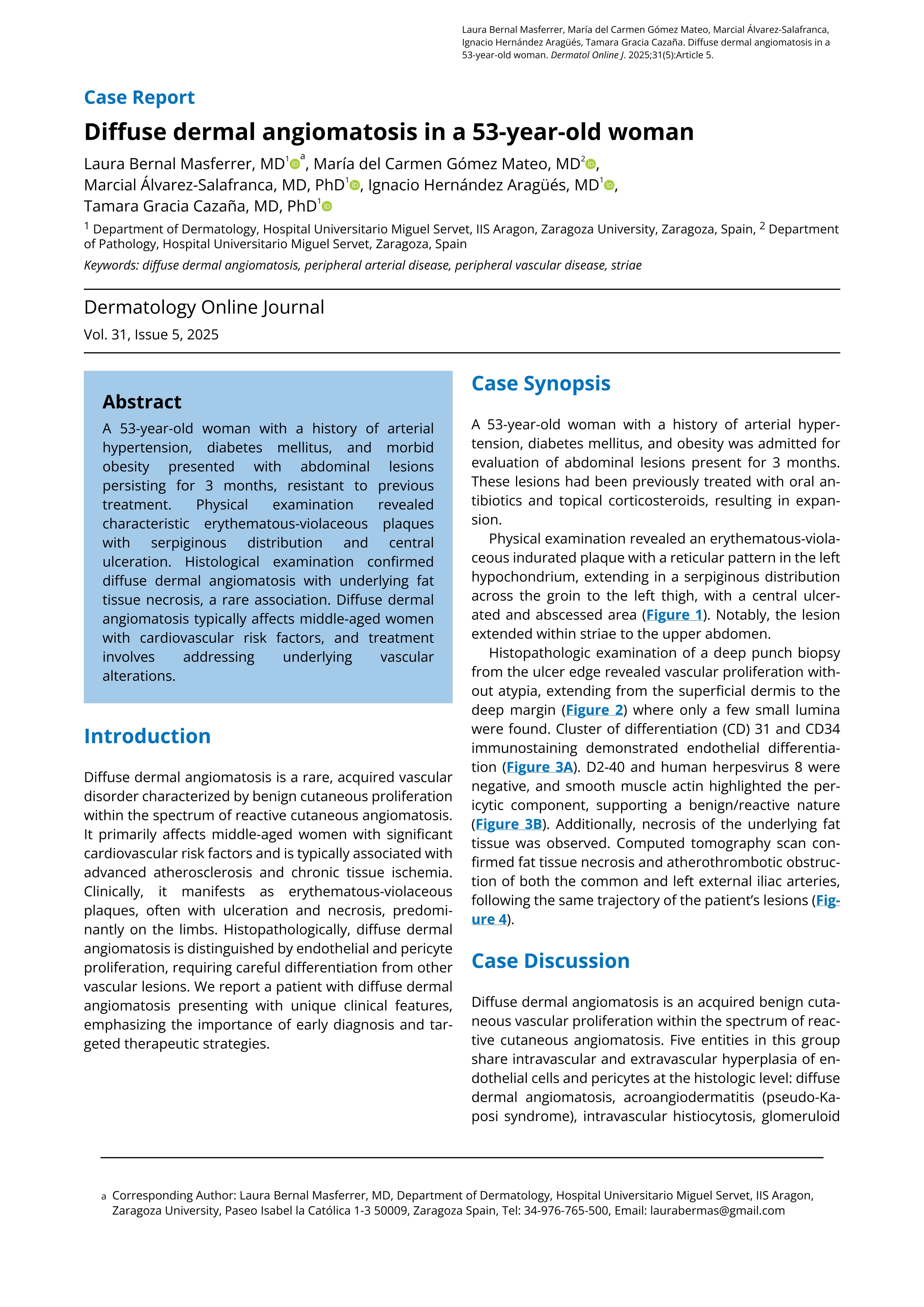 Diffuse dermal angiomatosis in a 53-year-old woman