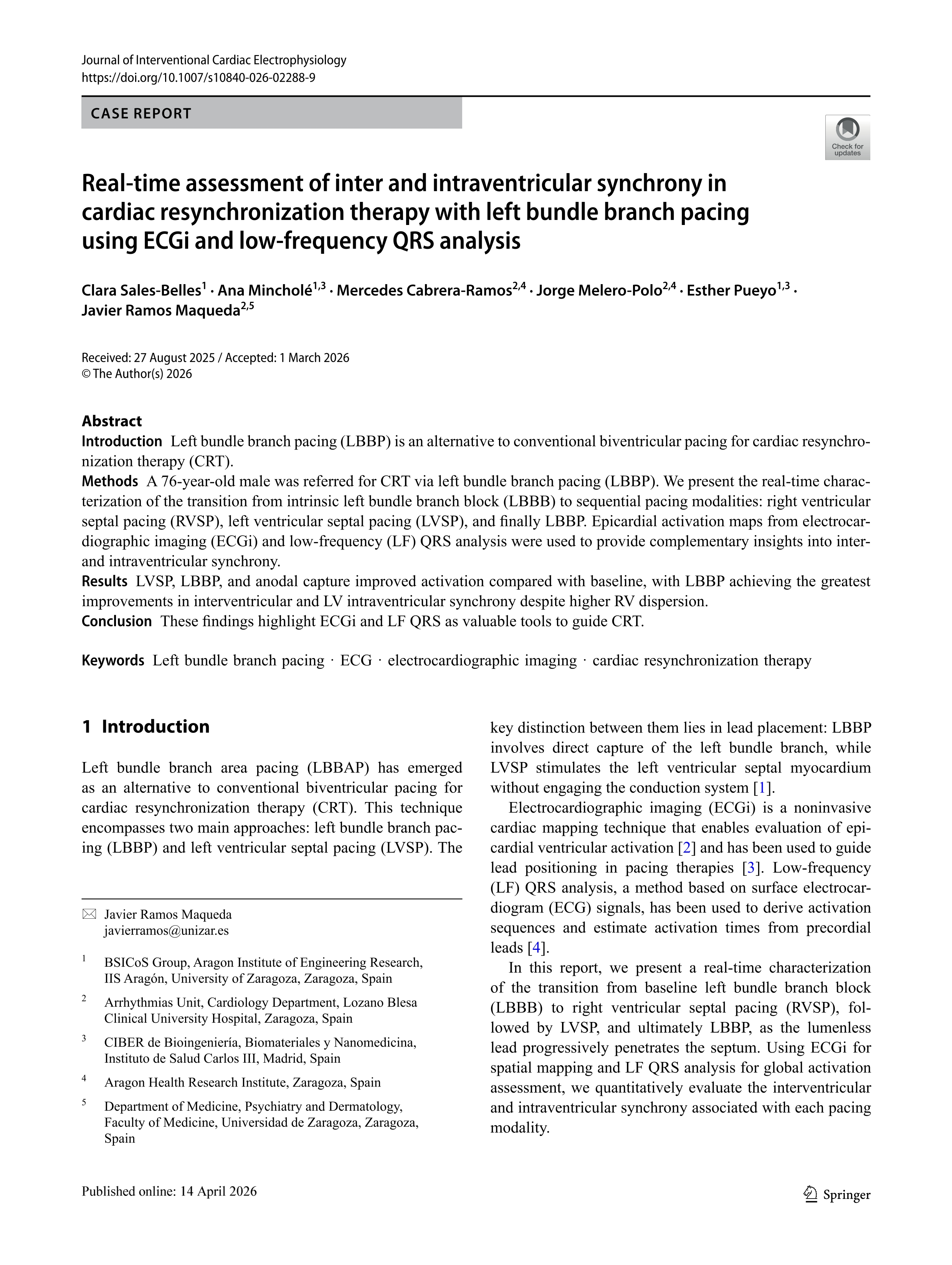 Real-time assessment of inter and intraventricular synchrony in cardiac resynchronization therapy with left bundle branch pacing using ECGi and low-frequency QRS analysis