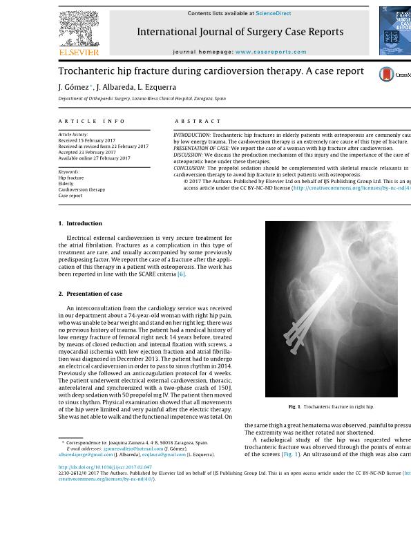 Trochanteric hip fracture during cardioversion therapy. A case report