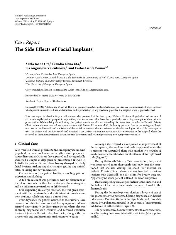 The Side Effects of Facial Implants