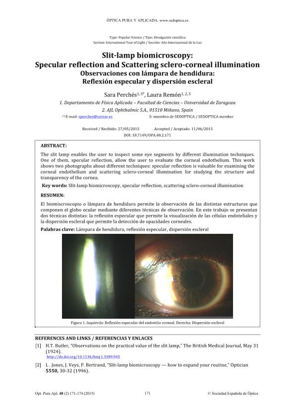 Observaciones con lámpara de hendidura: Reflexión especular y dispersión escleral