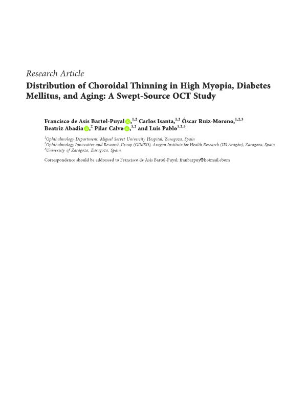 Distribution of Choroidal Thinning in High Myopia, Diabetes Mellitus, and Aging: A Swept-Source OCT Study