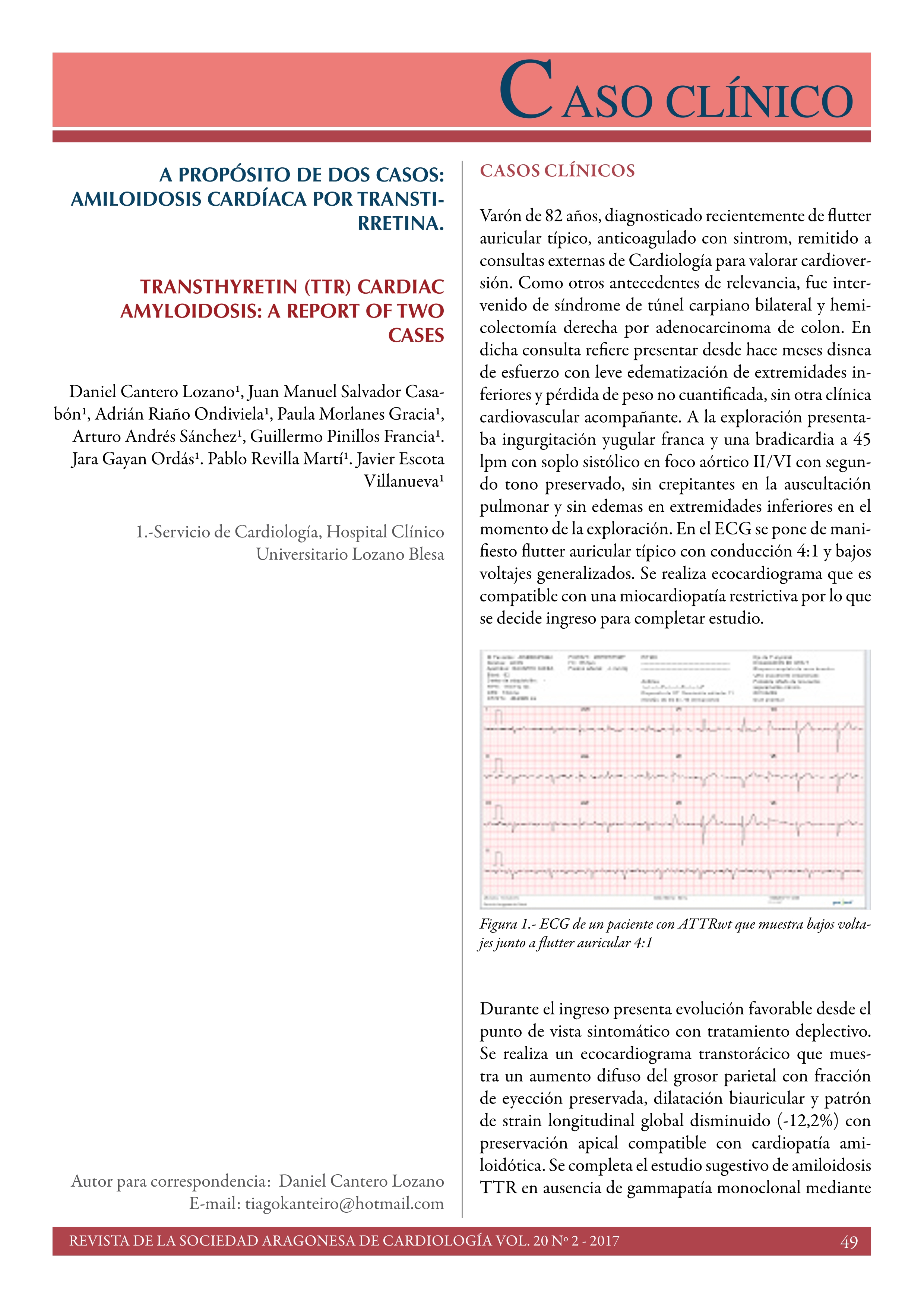 A propósito de dos casos: amiloidosis cardíaca por transtirretina